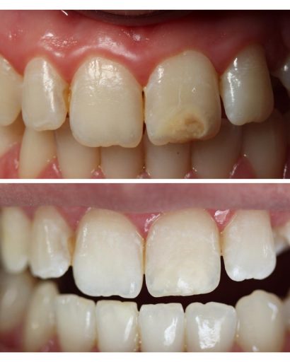 Before - Familydentalcarecentre