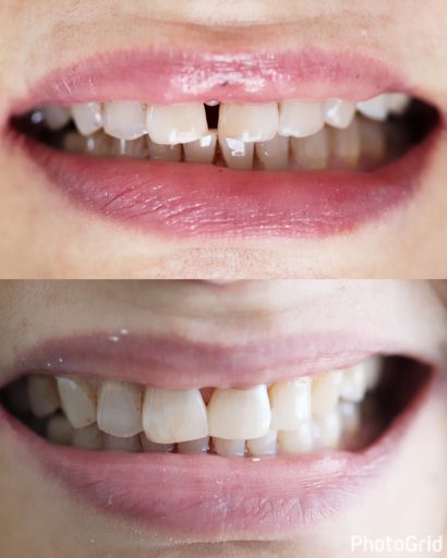 Before - Familydentalcarecentre