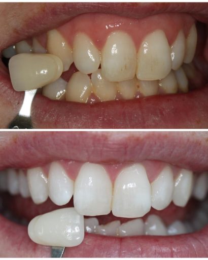 Before - Familydentalcarecentre