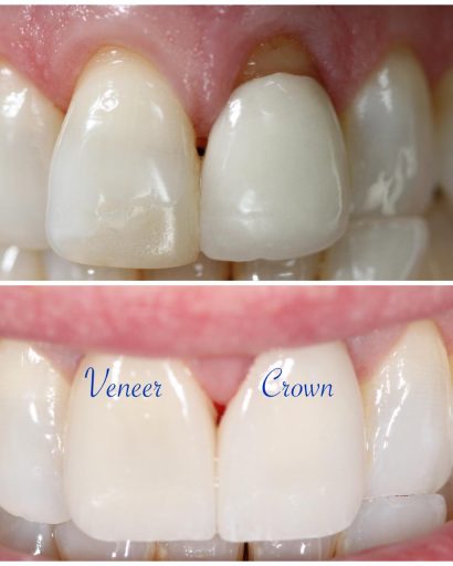 Before - Familydentalcarecentre