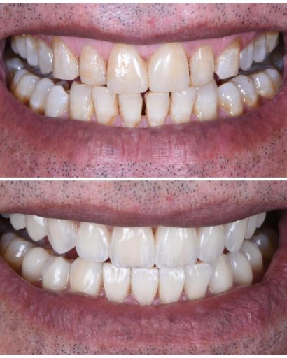 Before - Familydentalcarecentre