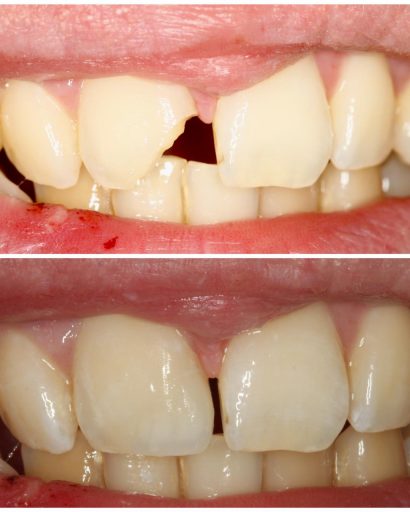 Before - Familydentalcarecentre