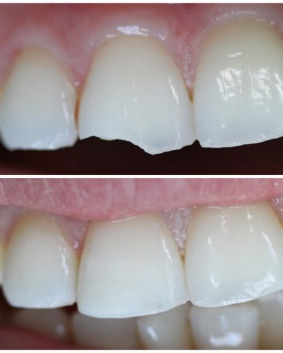 Before - Familydentalcarecentre