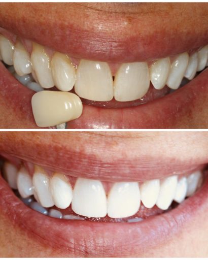 Before - Familydentalcarecentre