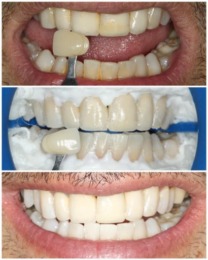 Before - Familydentalcarecentre